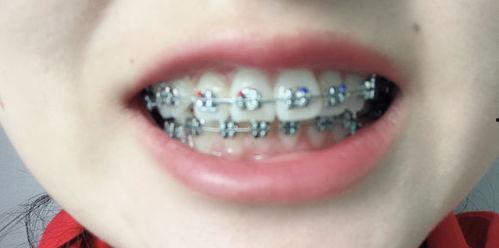 成人长新牙方法视频,跟随视频学习神奇再生术